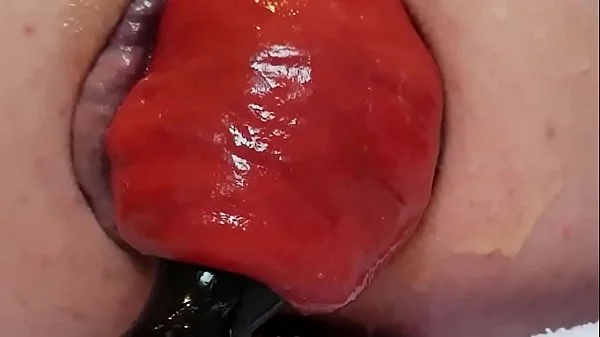 Contender For Biggest Prolapse (Male Warning!)