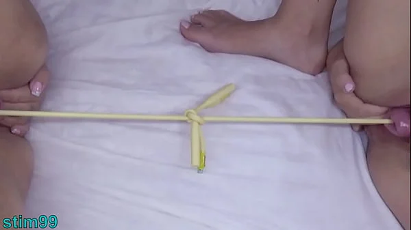 Prolapsed Cervix Lesbians at the same time