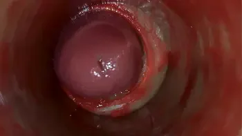 Camera Inside Deep Pussy Captures Huge Ejaculation of Sperm ASMR