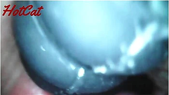 Endoscopic Vaginal Observation