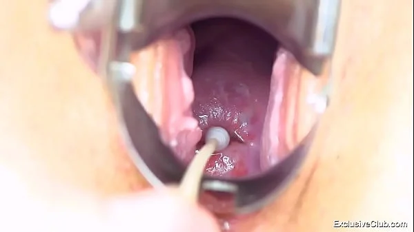 Diana gynecological examination